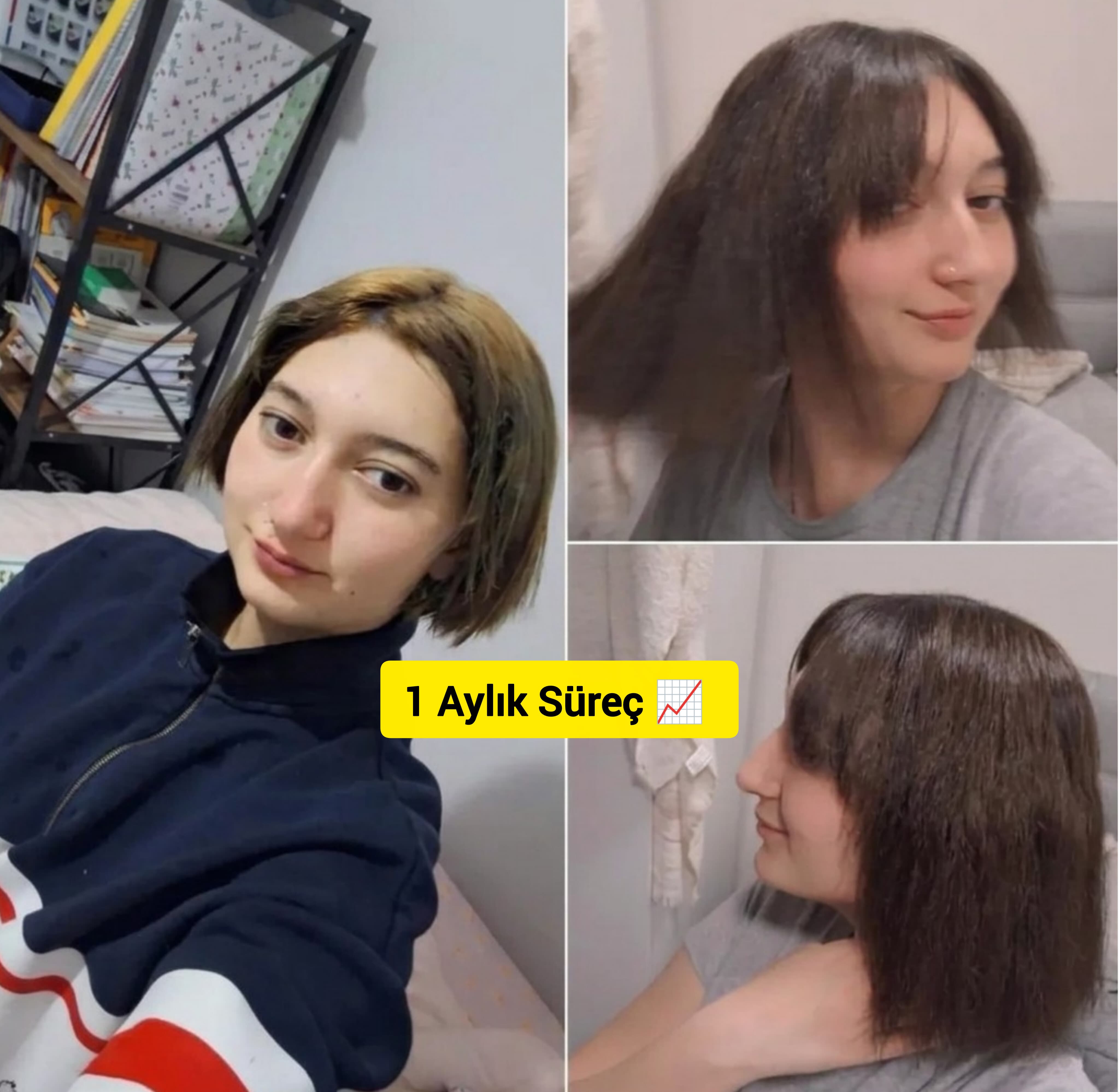 1 aylık süreç - saç uzama sonuçları